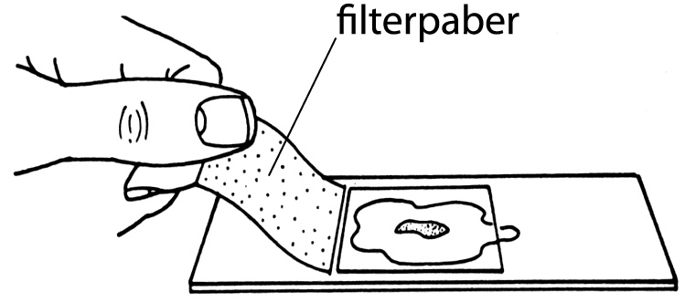 Pilt